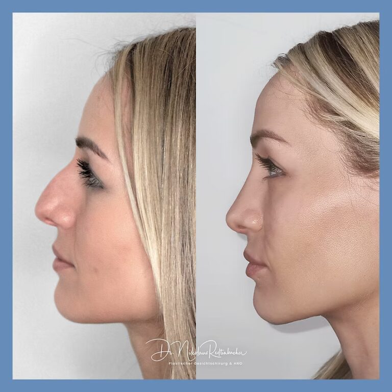 VN_20241023__P1__insta1080__01 (1)