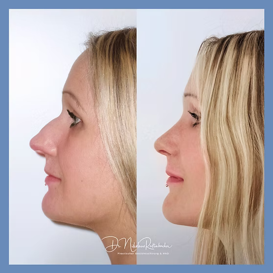 f0928b_e3b35f2d8cd1491f922fca0d7b948f1b~mv2