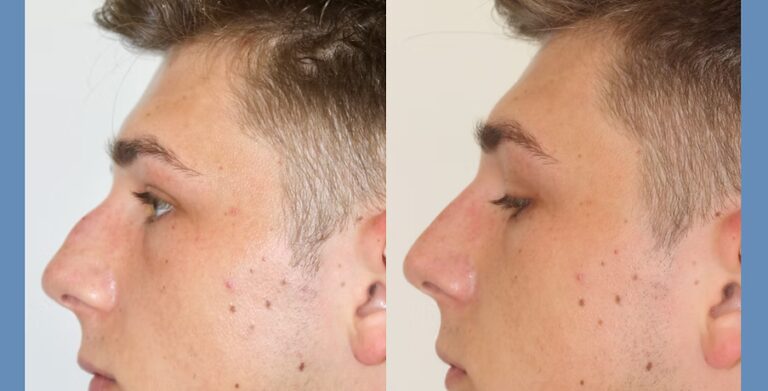 74e32b_2602a181251f46778b229d3d9e3547af~mv2