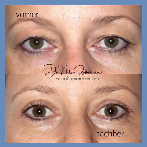 74e32b_56bad9dcc5a94e6f9e36411227afef80~mv2