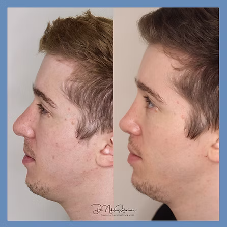 74e32b_bda763142ae9420a9f9ebcee142913fe~mv2