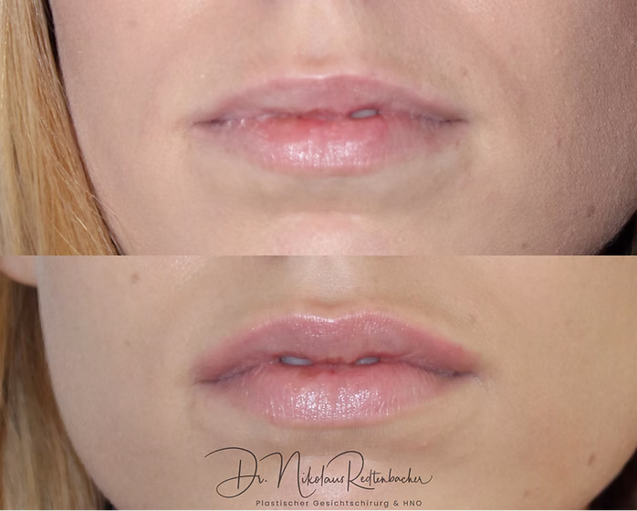 74e32b_d9090ddb5b4b4c559d41a1741e19bb9a~mv2