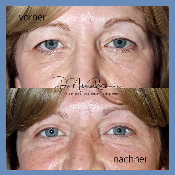 74e32b_fd67d096f177441ebef34f6158278137~mv2