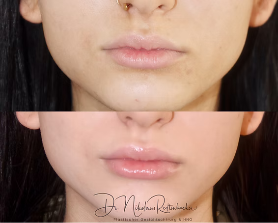 D970B95F-271F-44DC-B314-3655058CECED