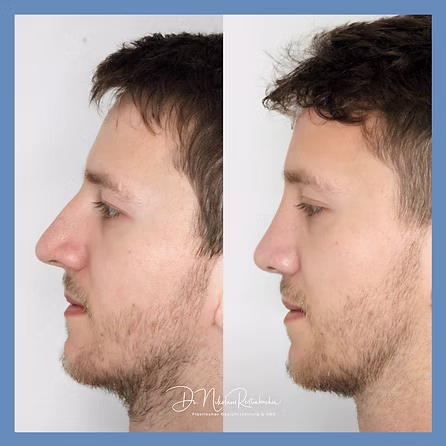 f0928b_6a418764cc9746adb1ba872b8b35d0dd~mv2