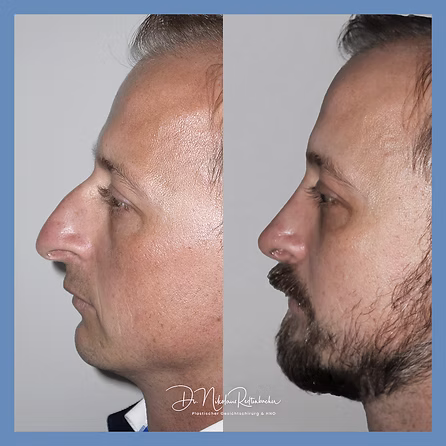 f0928b_b04404bd20ae41ea833f0117ea1dd964~mv2