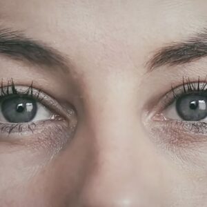 Augenlidstraffung ohne OP: Die besten nicht-invasiven Methoden für strahlende Augen