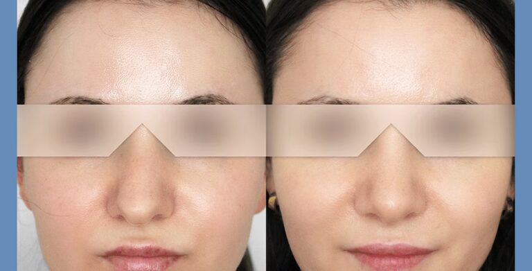 f0928b_e5771dbd56a44bb284ba5c0e6f7308c8~mv2