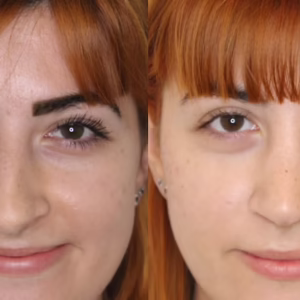 An der Nase abnehmen - img.3